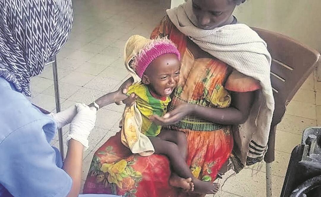 Medhin Gereziher, de un año, al recibir en 2022 tratamiento por desnutrición en un hospital en Mekele, en Tigray, Etiopía. Foto: Archivo/ AP