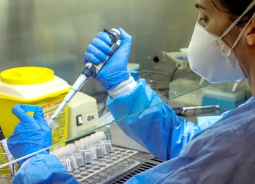 The UNAM is approved to analyze COVID-19 rapid tests