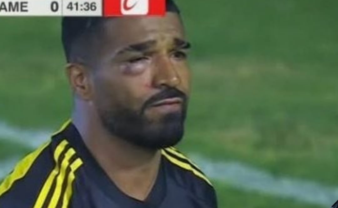 El delantero uruguayo salió del partido y generó preocupación entre los seguidores