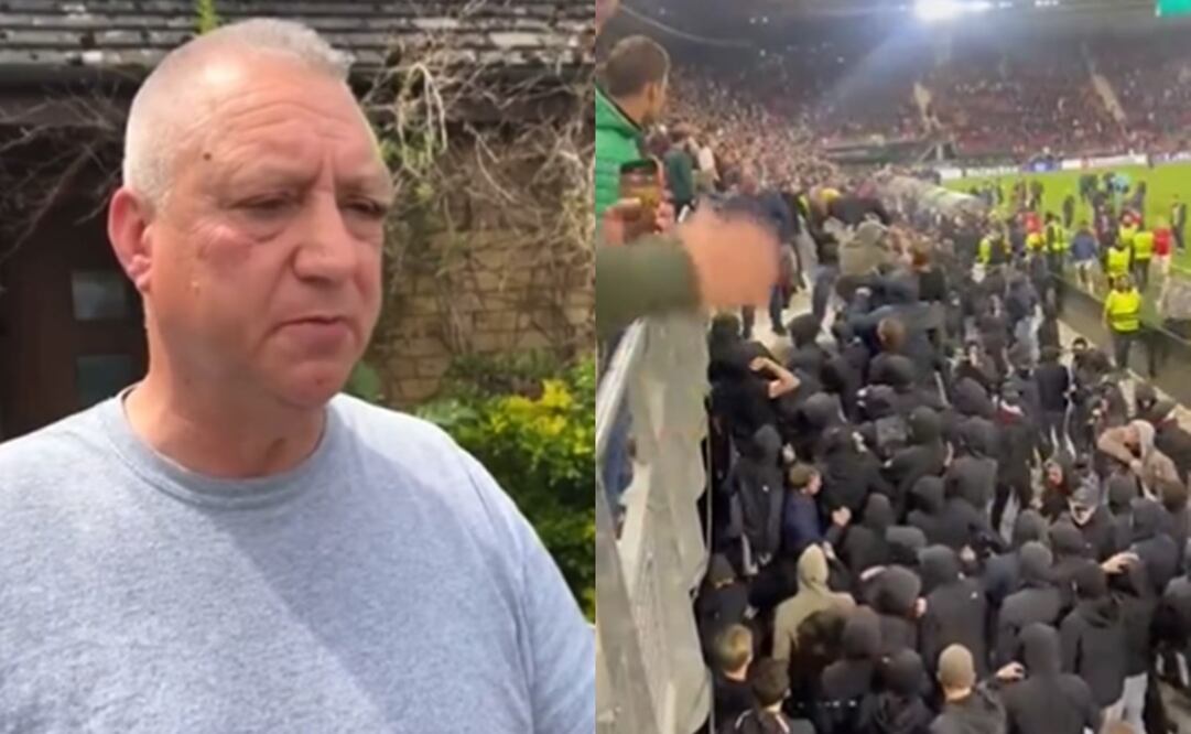 Knollsy, uno de los aficionados que defendió a las personas de los encapuchados - Foto: Especial