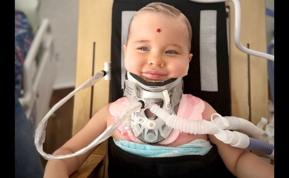 Morelia, Mich.— Después de que un accidente automovilístico dejó a Oliver, de entonces un año, con la cabeza desprendida de la columna vertebral, hoy tras varias cirugías se está recuperando y recibe terapias en el CRIT de Michoacán. Foto: Cortesía Familia Staub.