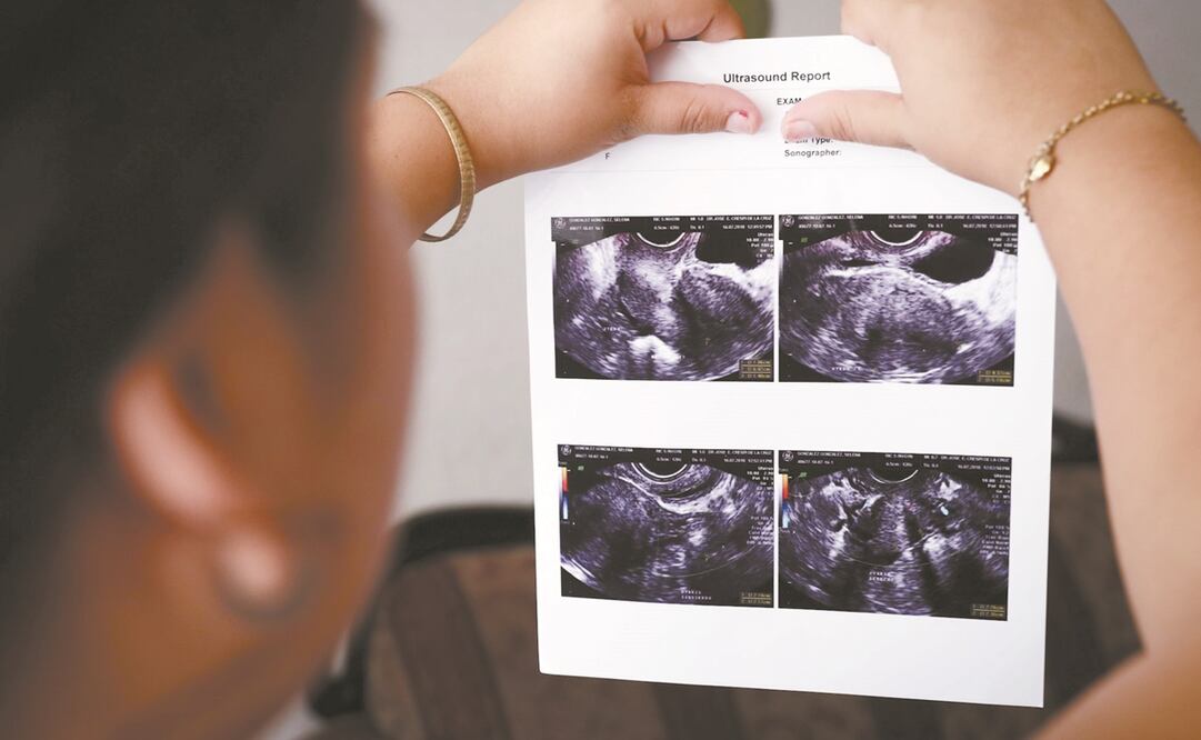 Foto: Diego Simón Sánchez / EL UNIVERSAL