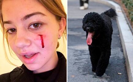 Mascota de los Obama muerde a una joven en la cara