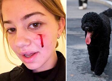 Mascota de los Obama muerde a una joven en la cara