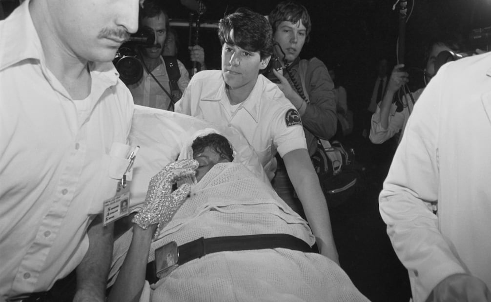 Una de las imágenes más impactantes en la carrera de Michael Jackson. Foto: Bettmann Archive