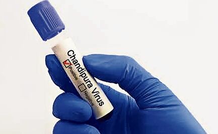 ¿Qué es la encefalitis? Conoce el letal virus Chandipura