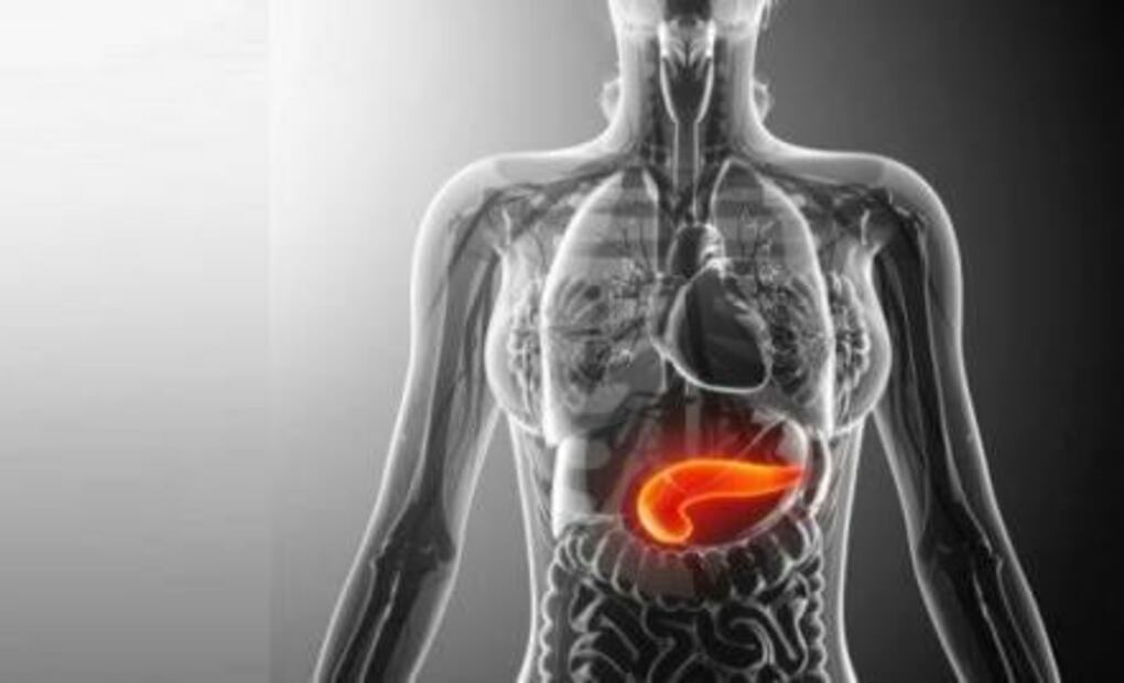 ¿Qué es la Pancreatitis Aguda?