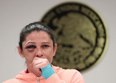 Otorgan suspensión para evitar detención de agresor de Ana Guevara