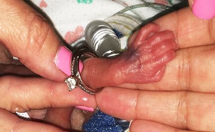 "Niña milagro" sale del hospital en Miami; pesó al nacer 368 gramos