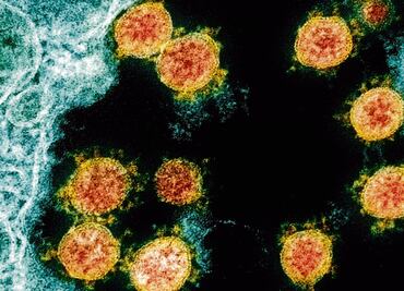 Descartan “variante mexicana” de Covid-19 en Jalisco