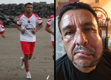 Jugador de la Liga de Balompié Mexicano golpea a árbitro; lo separan del equipo