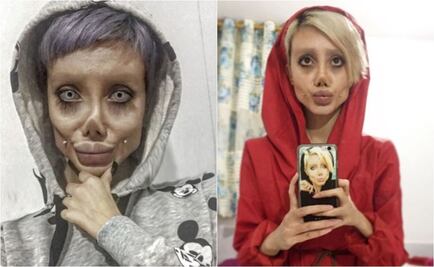 Joven iraní afirma que pasó por 50 cirugías para parecerse a Angelina Jolie