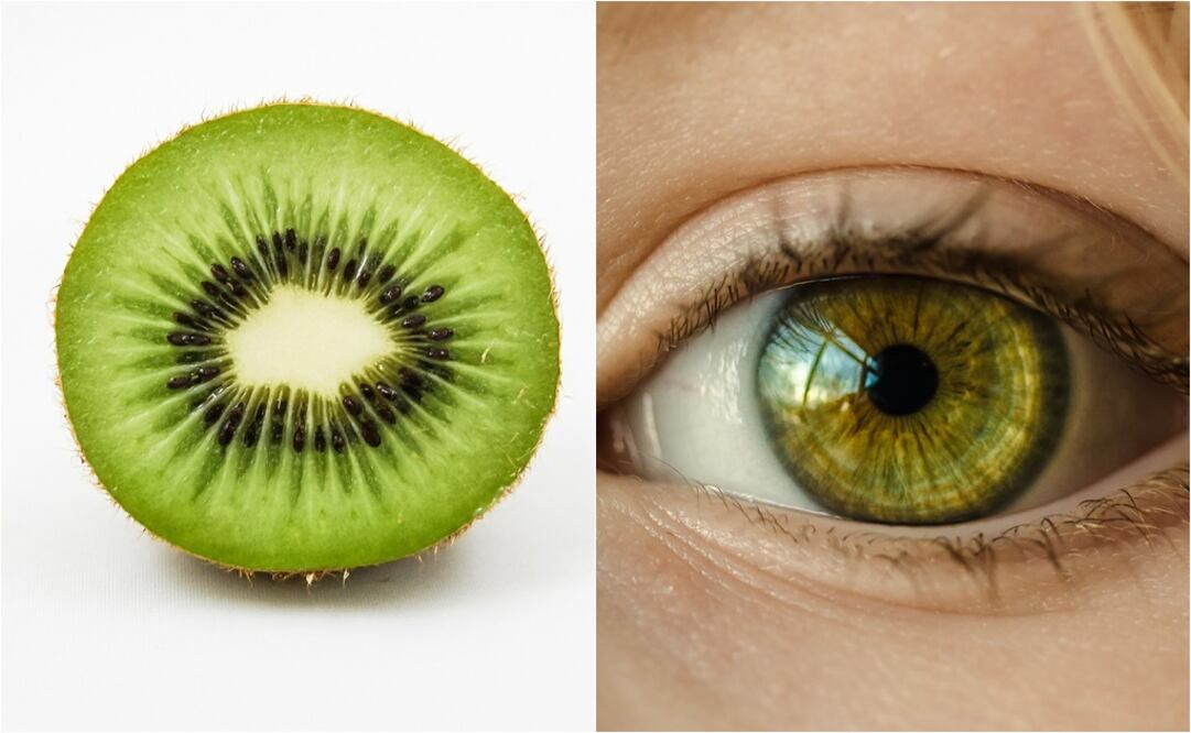 El kiwi tiene un pigmento que forma parte de la retina y evita que los ojos sean dañados por los rayos ultravioleta; además de cataratas. (Fotos: Pixabay)