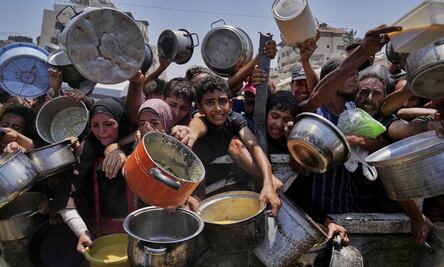 FOTOS: Uno de cada cinco niños en Gaza padece desnutrición aguda