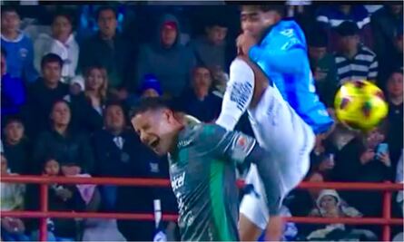 James Rodríguez recibe criminal patada ante Pachuca; fanáticos colombianos explotan por la acción