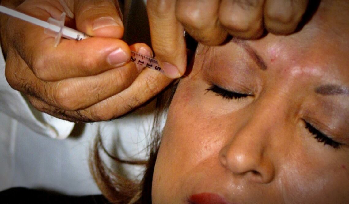 El diputado Reyes Carmona, presidente de la Comisión de Salud, subrayó la importancia de que sea un especialista quien esté al frente de dichos procedimientos estéticos. Foto: archivo/EL UNIVERSAL