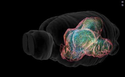 Qué es la enfermedad vascular cerebral y cuáles son sus secuelas
