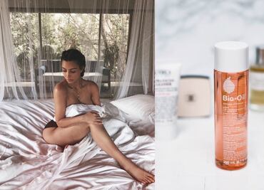 Kim Kardashian revela el remedio para combatir las estrías