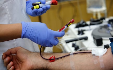 ¿Te recuperaste de Covid-19? Así puedes ayudar a otros