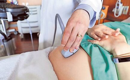 Acto de discriminación, despedir a una mujer por estar embarazada: Suprema Corte