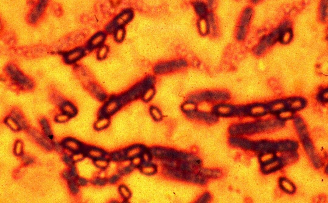 La bacteria del ántrax, que fue usada en el pasado como arma biológica, puede ser letal y afecta tanto a seres humanos como al ganado. Foto: Reuters/Archivo