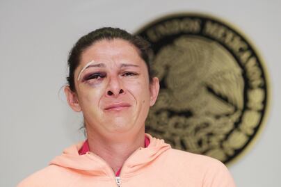 Presumen que golpeador de Ana Guevara es policía