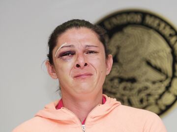 Presumen que golpeador de Ana Guevara es policía