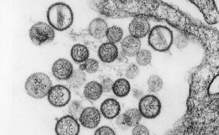 ¿Qué son los hantavirus?