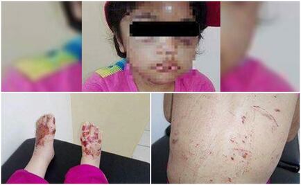 Rescatan a niña maltratada por sus padres en Sonora