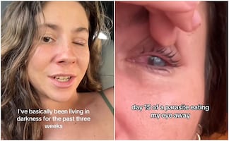 VIDEO: extranjera cuenta cómo fue que un parásito devoró la córnea de su ojo mientras vivía en México