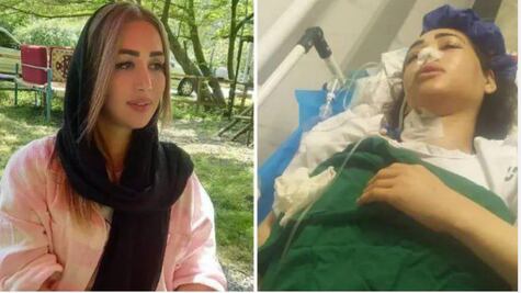 Por no llevar hiyab, mujer tiroteada por agentes en Irán queda paralítica