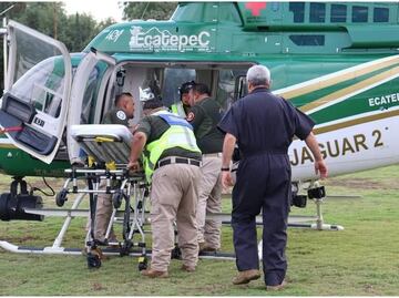Solicitan donadores para bebé que sufrió quemaduras de tercer grado en incendio en Teoloyucan