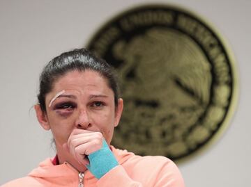 Atacan en redes a Ana Guevara tras agresión