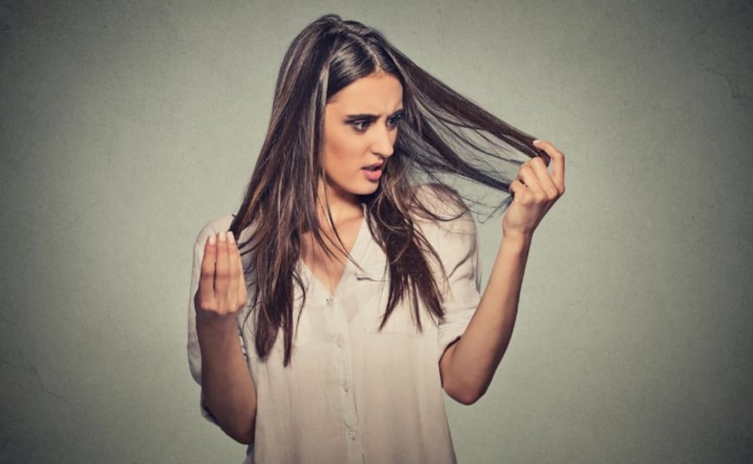 La paciente fue diagnosticada con el Síndrome de Rapunzel. (FOTO: Especial)