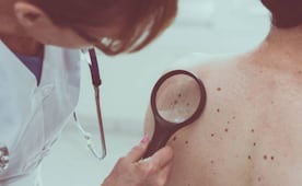 Merck y Moderna anuncian resultados positivos de su vacuna contra el cáncer de piel; es para pacientes con melanoma avanzado