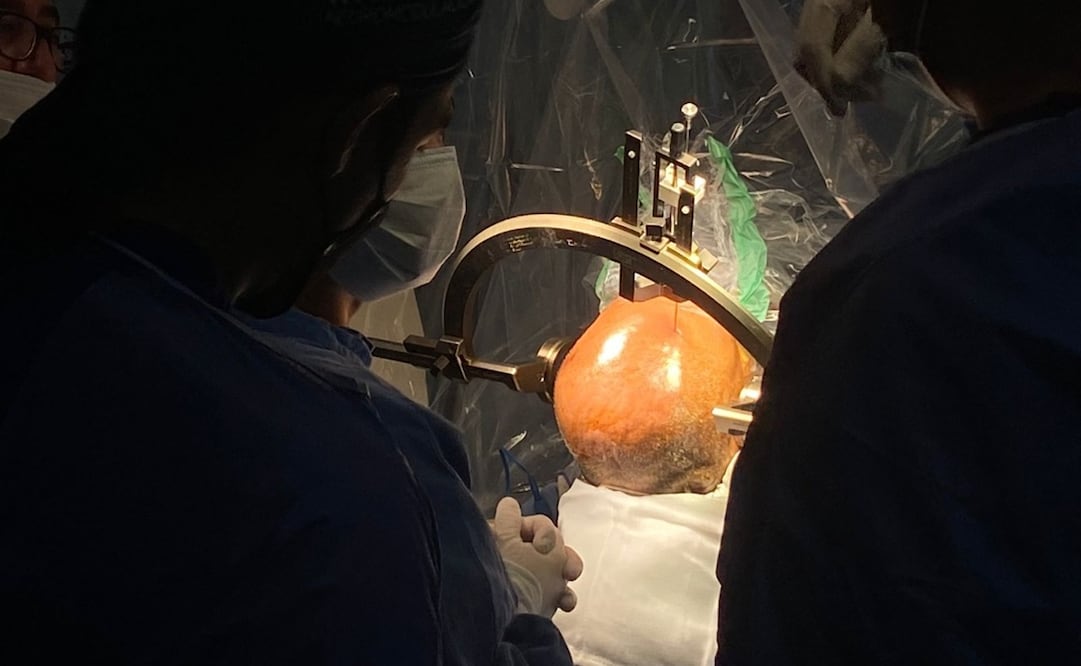 Antes de dicha intervención, don Carlos tenía una funcionalidad de apenas un 15%, y afectaba su movilidad, su lenguaje. Foto: Especial 