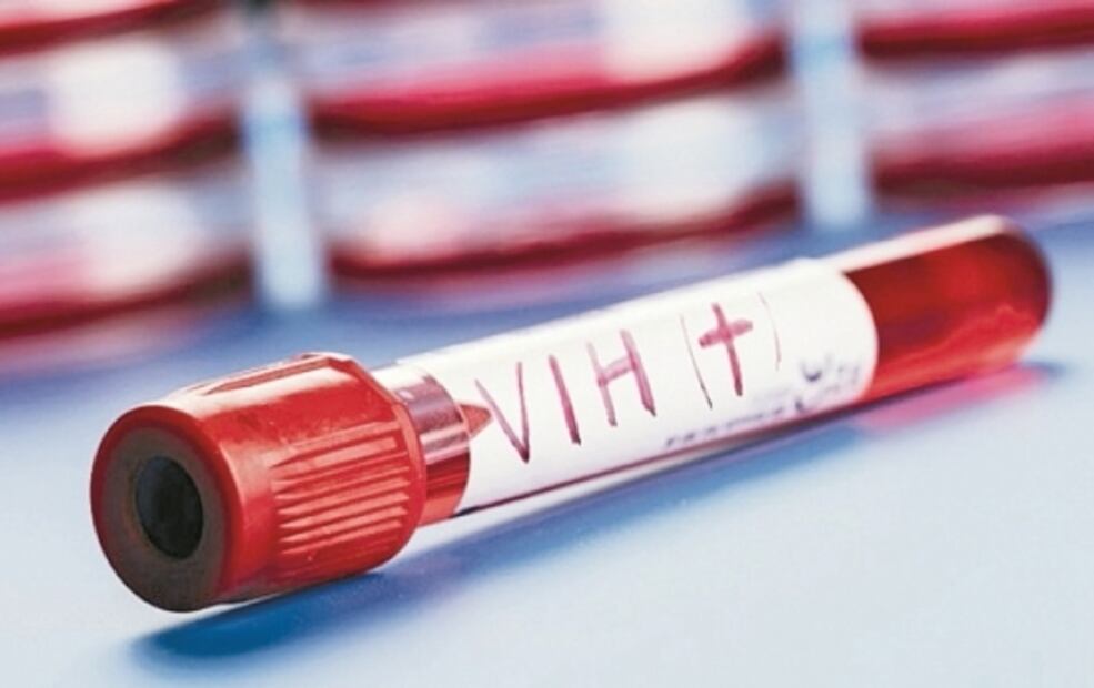 Descubren que prometedor fármaco para prevenir el VIH tiene algunas desventajas