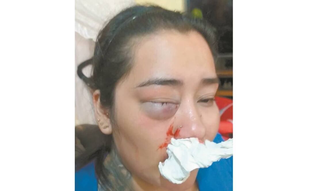Una de las brigadistas agredidas en Coyoacán. Foto: Especial.