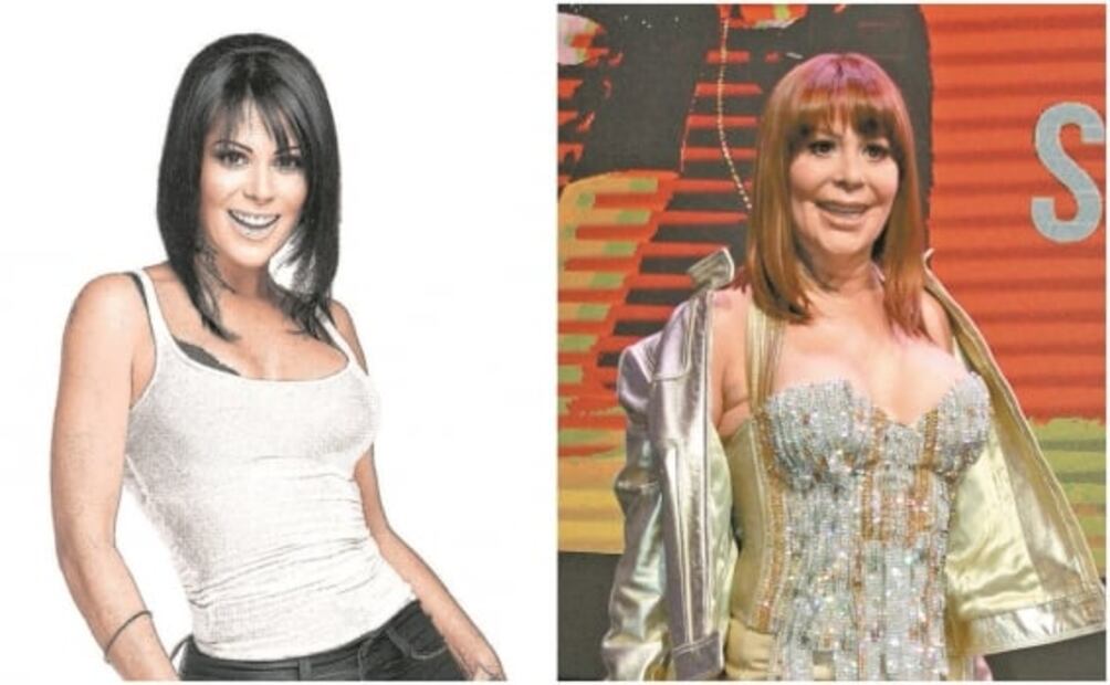 Famosos que recurren a la cirugía estética para ser mejores