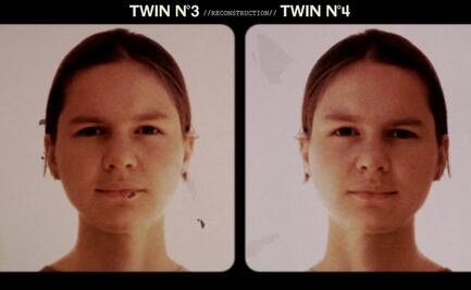 Las gemelas separadas al nacer como parte de un oscuro experimento que se reencontraron décadas después