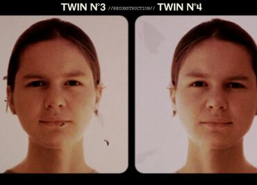 Las gemelas separadas al nacer como parte de un oscuro experimento que se reencontraron décadas después