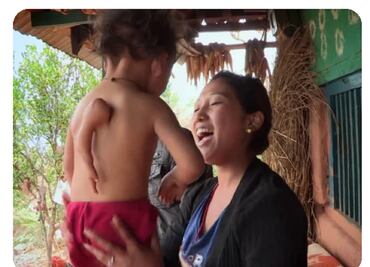 Gaurab Garum, el niño que nació con un tercer brazo en la espalda