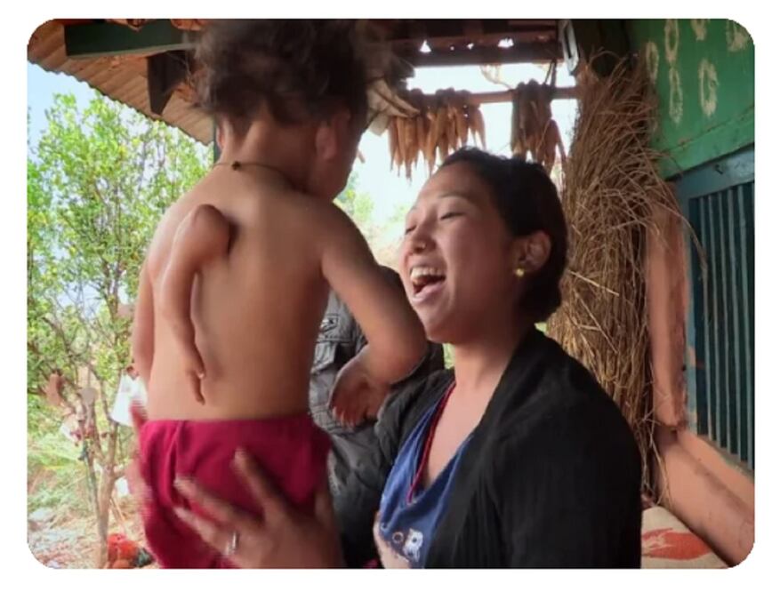 Gaurab Garum vive en Nepal. Su caso se volvió viral al ser difundido en video. FOTO: CAPTURA