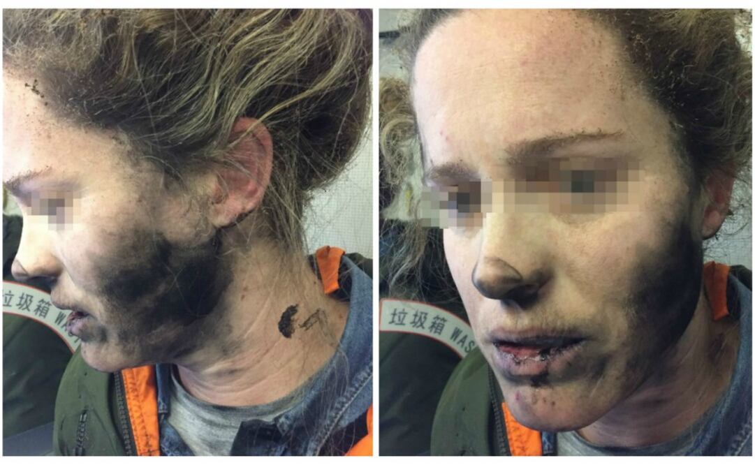 La pasajera, que sufrió quemaduras en el rostro y cuello, tiró el aparato al suelo e intentó apagar el incendio con los pies