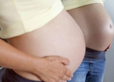 Zika-exposed babies born without microcephaly in Yucatán