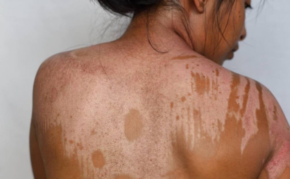 Fotógrafo de EL UNIVERSAL es reconocido con Premio Alemán de Periodismo Walter Reuter