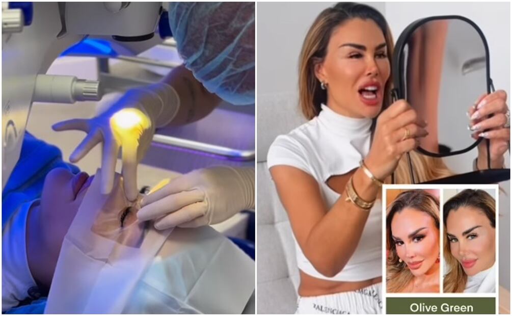Ninel Conde se somete a una queratopigmentación para cambiar permanentemente el color del iris.