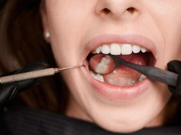 La especia egipcia que disminuye el riesgo de aparición de caries