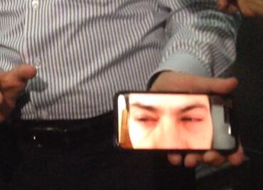 Ssa: rayos ultravioleta afectaron a funcionarios