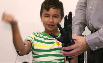 Desarrollan prótesis robóticas para niños
